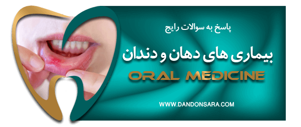 سوالات دندانپزشکی بیماریهای دهان و دندان